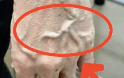 Se una persona ha vene visibili, significa che ha una cattiva circolazione?… Vedi altro