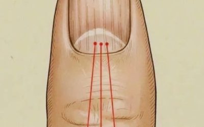 Cosa mangiare per ridurre le striature sulle unghie: una guida nutrizionale per unghie più sane