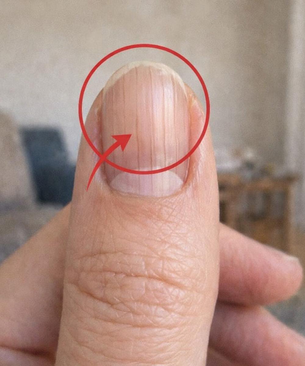 Un medico scopre un segno rivelatore nelle unghie che potrebbe predire la tua aspettativa di vita