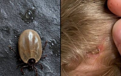 Come mantenere la calma quando si trovano “ospiti” indesiderati tra i capelli del proprio bambino.