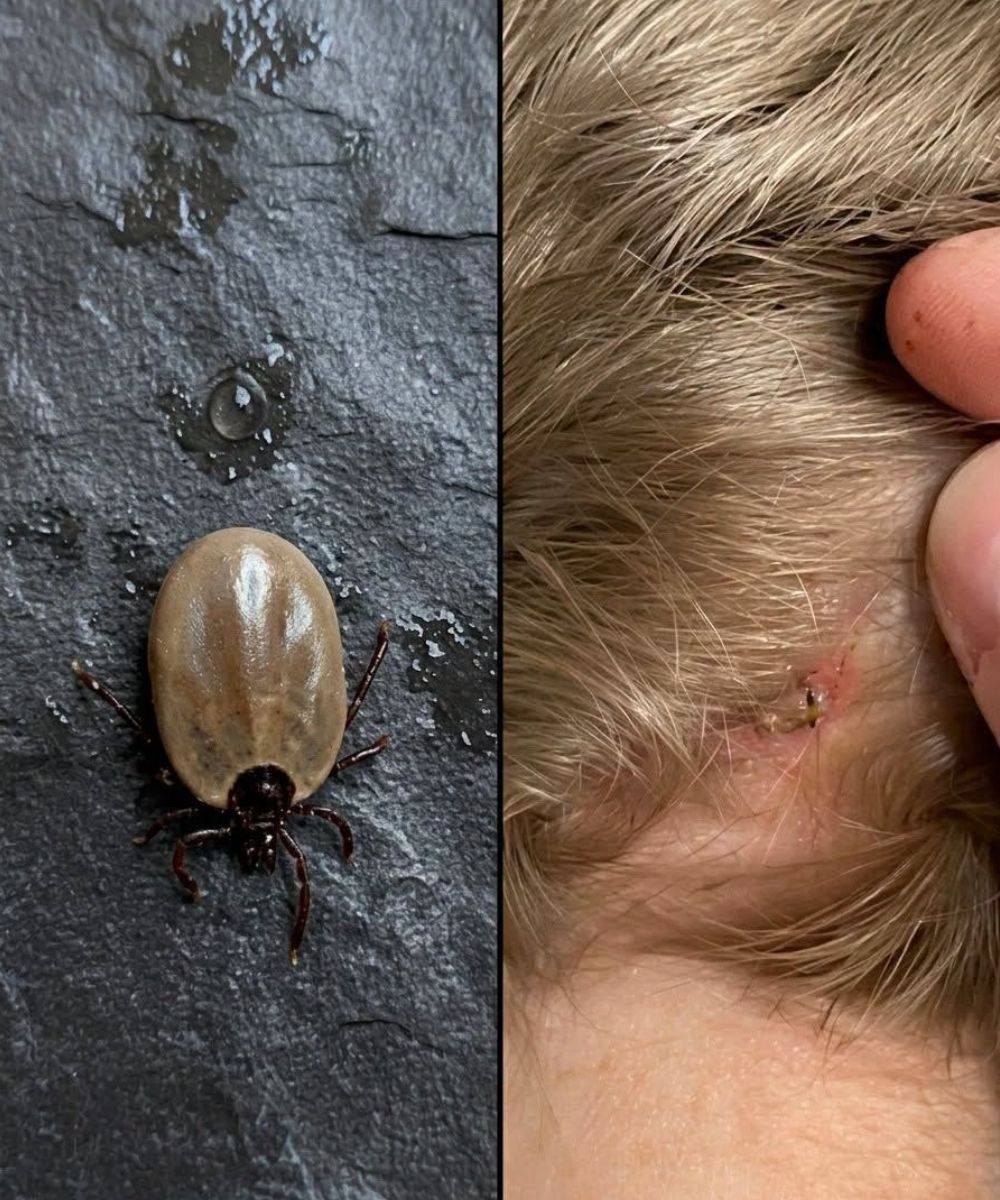 Come mantenere la calma quando si trovano “ospiti” indesiderati tra i capelli del proprio bambino.