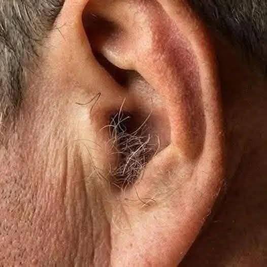 LO SAPEVI? Se ti crescono i peli sulle orecchie, è perché il tuo corpo è…