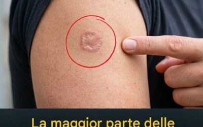 Cicatrice rotonda sul braccio: cosa significa?