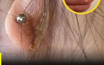 Odore di croste dietro le orecchie: cause reali e come identificare il problema precocemente