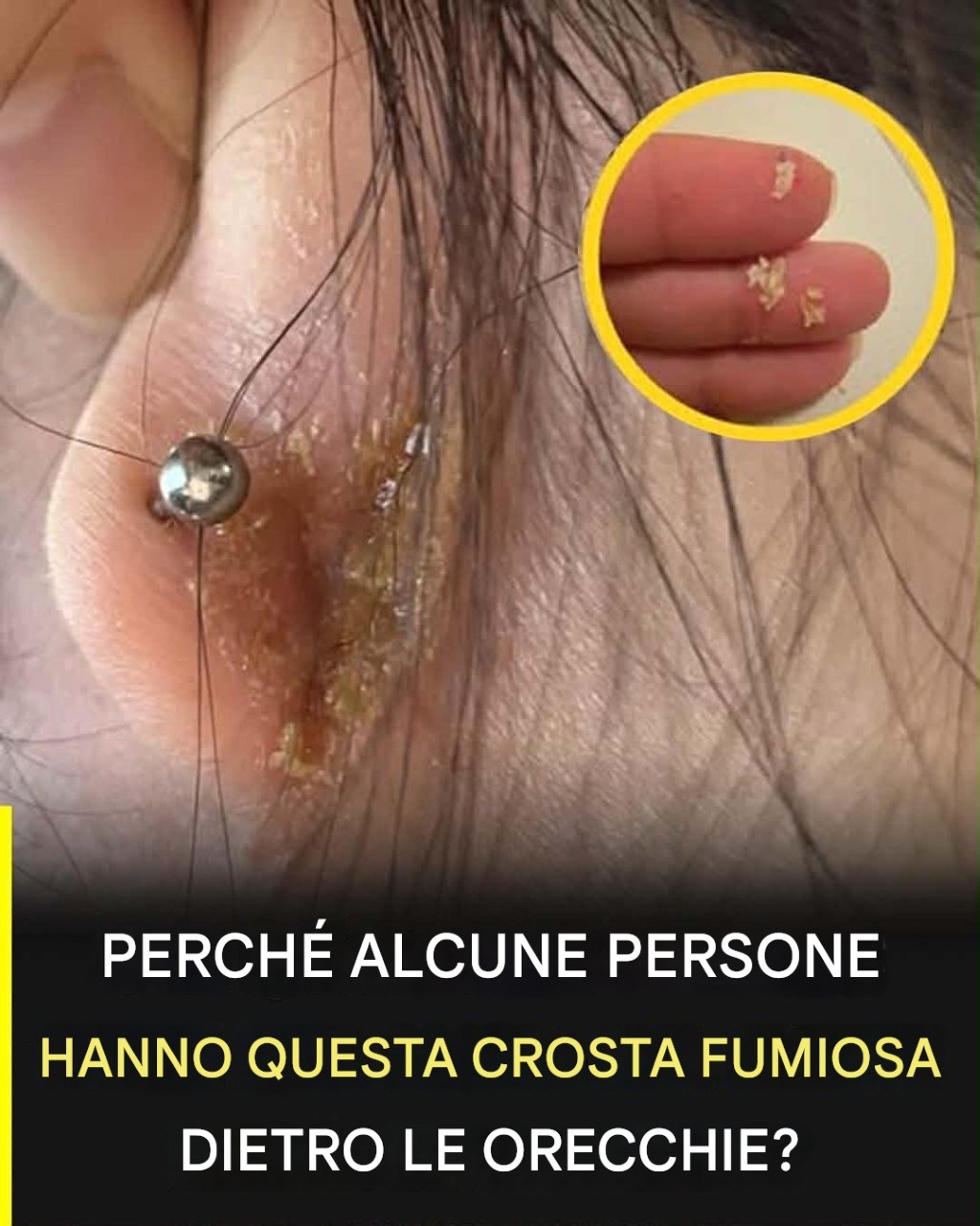 Odore di croste dietro le orecchie: cause reali e come identificare il problema precocemente