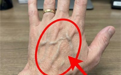 Se hai vene visibili, significa che sei…
