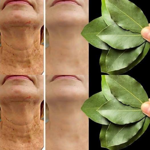 La folha de louro è 100.000 volte più potente del Botox? | Elimina le rughe naturalmente, mesmo aos 70 anos!