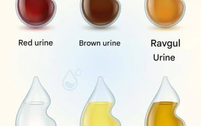 Cosa rivela il colore della tua urina sulla tua salute