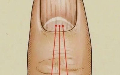 Cosa mangiare per ridurre le striature sulle unghie: una guida nutrizionale per unghie più sane