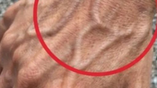 Se hai vene visibili, significa che sei…