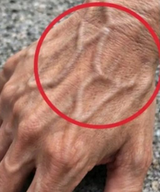 Se hai vene visibili, significa che sei…