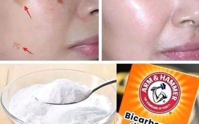 4 modi per eliminare le macchie dell’età con il bicarbonato di sodio per una pelle più giovane e uniforme