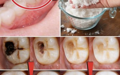 Abitudini intelligenti per proteggere i denti