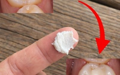 5 semplici rimedi naturali casalinghi per prevenire la carie e favorire la salute dei denti