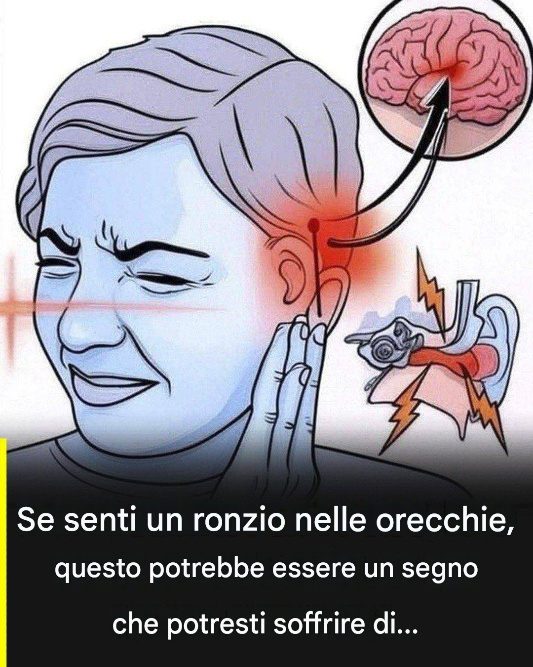 Acufeni: cosa rivelano sulla tua salute e perché non dovresti ignorarli