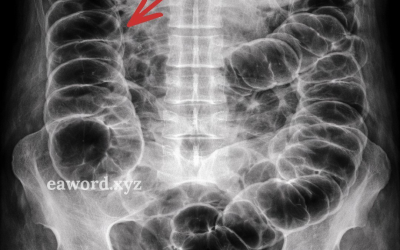 Gas intestinale: cosa sta cercando di dirti il ​​tuo corpo (e quasi nessuno lo spiega bene).