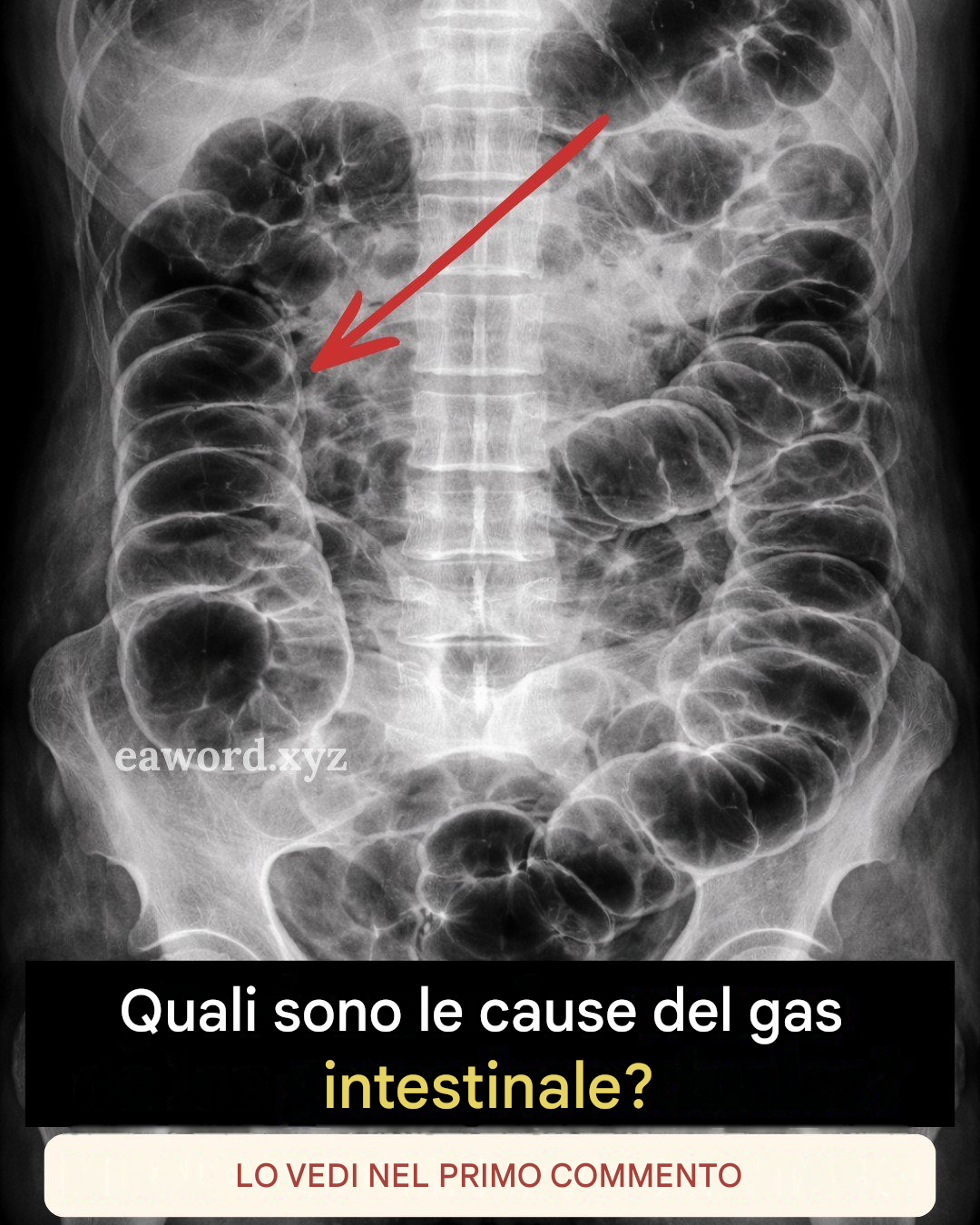 Gas intestinale: cosa sta cercando di dirti il ​​tuo corpo (e quasi nessuno lo spiega bene).