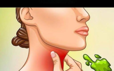 Le vere cause del catarro e del muco persistenti in gola e come eliminarli