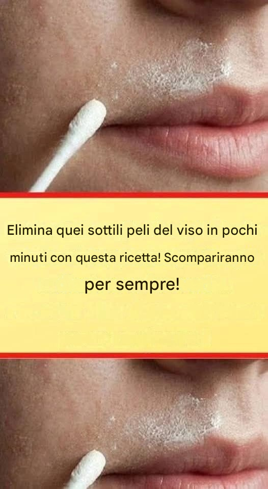 Questa ricetta naturale rimuoverà definitivamente i peli del viso.