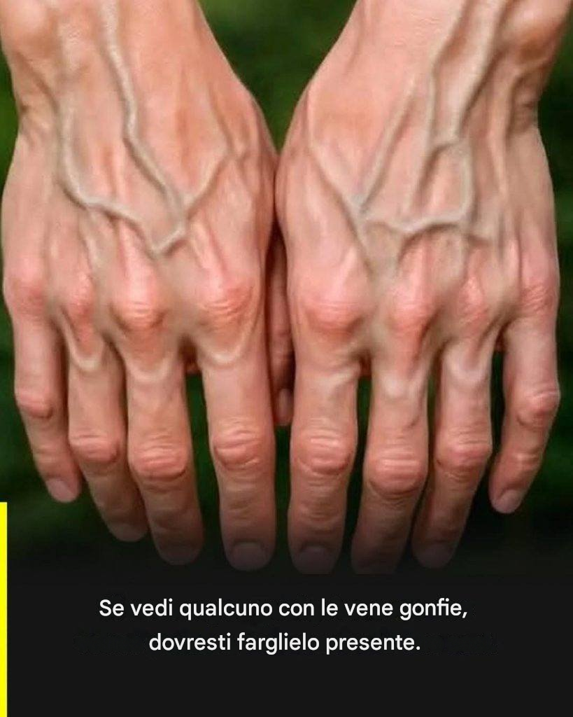 Se le tue vene sono visibili, significa che sei… Vedi altro