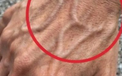 Se hai vene visibili, significa che sei…