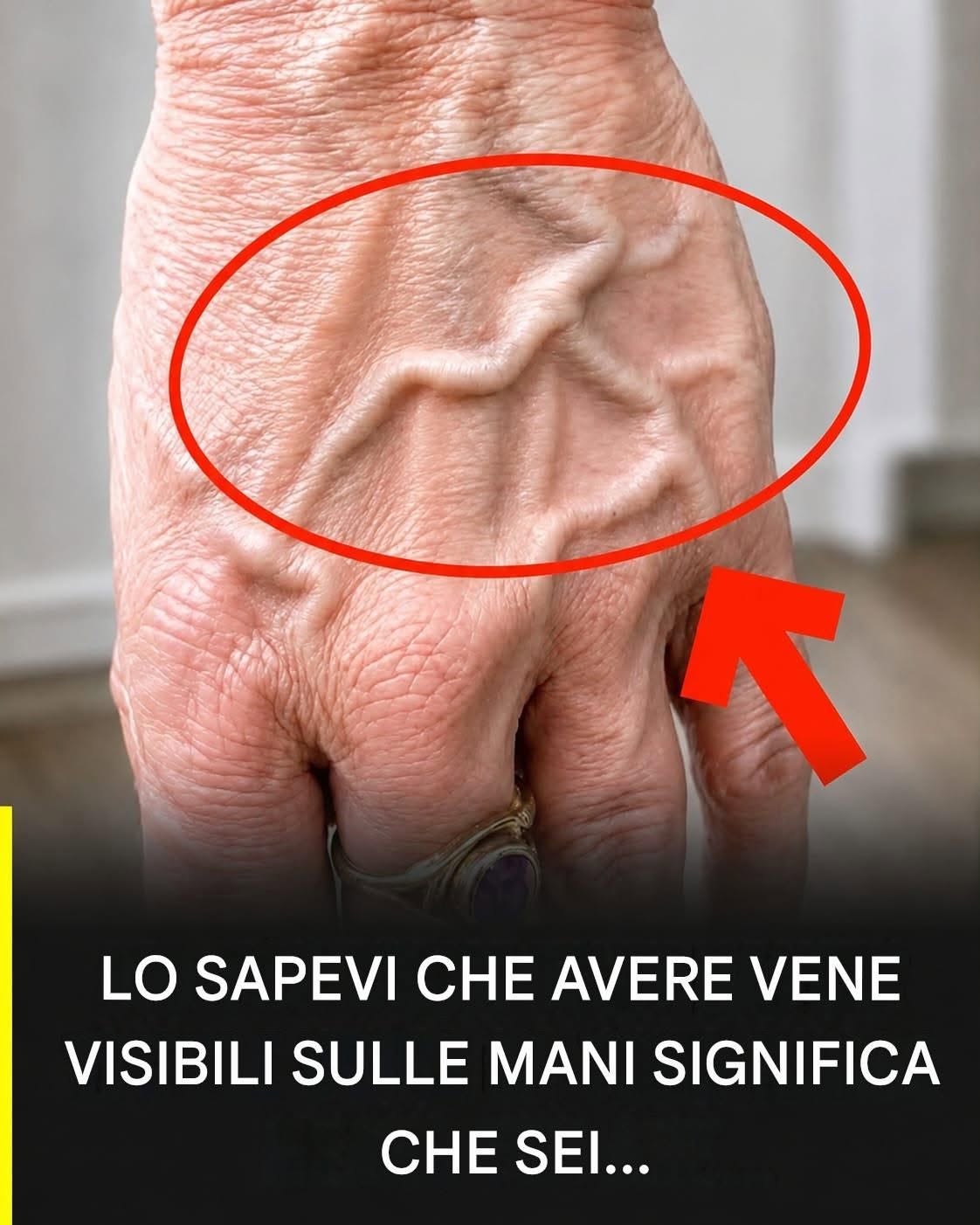 Perché alcune persone hanno vene molto evidenti sulle mani? Scopritelo qui.