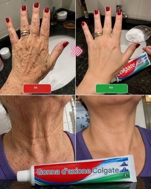 Guarda questo… Quelle mani sembravano vecchie, piene di macchie… Leggi di più nel primo commento. Guarda questo… Quelle mani sembravano vecchie, piene di macchie… Leggi di più nel primo commento.