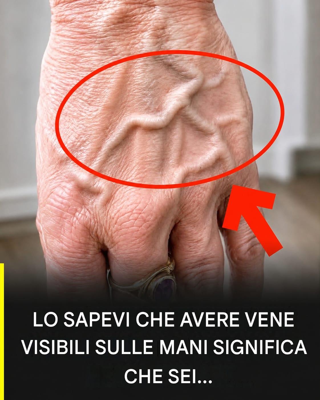 Lo sapevi che avere vene visibili significa che sei… Vedi altro